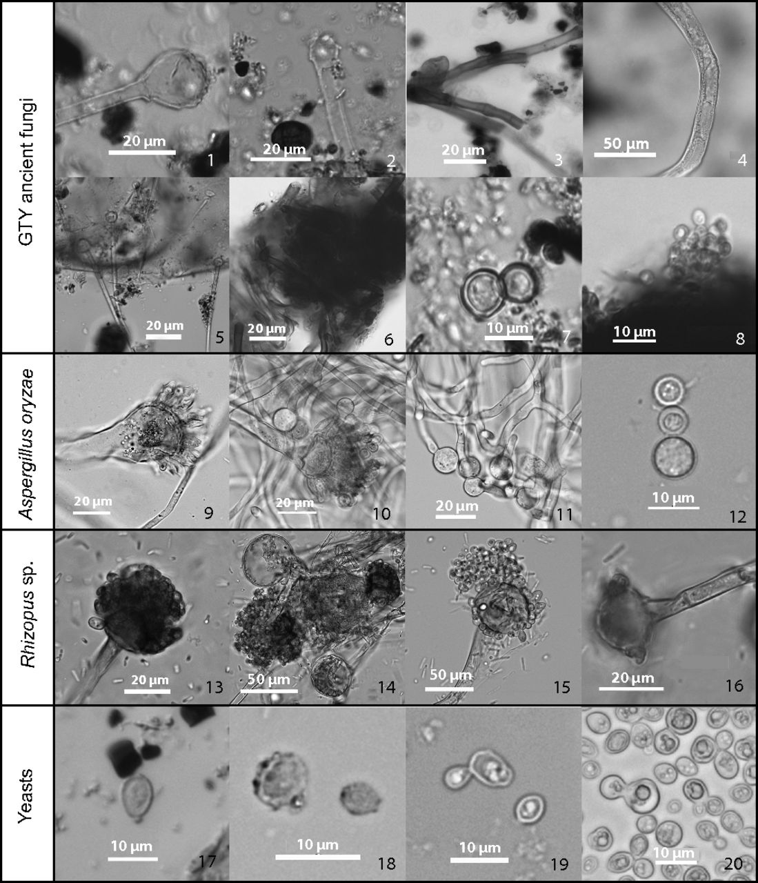 Neolithic fungi Several microscope images of fungal spores and yeast cells.