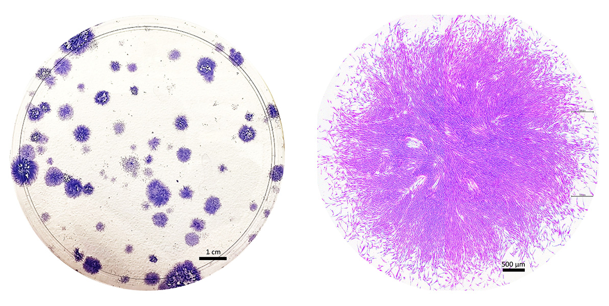 Menstrual stem cell clones Stem cells derived from menstrual fluid, shown at different magnifications.