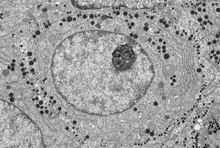 Membranes or not Micrograph of part of a cell showing many of its internal structures, some bounded by membranes and others not.