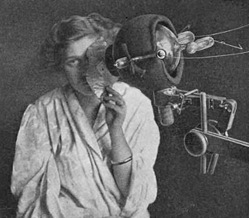 Historic X-ray treatment Black and white photo shows a woman in a gown with an X-ray tube in front of her. Part of her face is covered in order to direct the X-ray beam to the site of the cancer on her face.