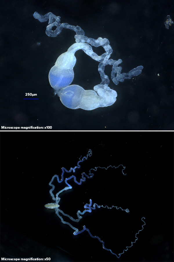 Ovaries and venom glands Photo of dissected ovaries (top) and venom glands (bottom), both pale blue in color, against a dark background.