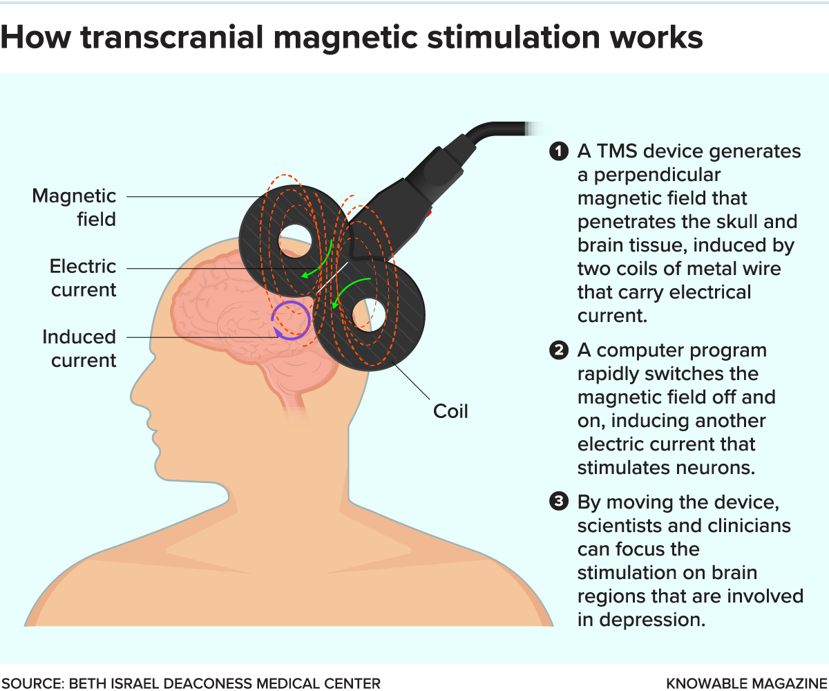 How TMS works An illustration showing a flat TMS device positioned over the left side of a person’s head, emitting a perpendicular magnetic field.