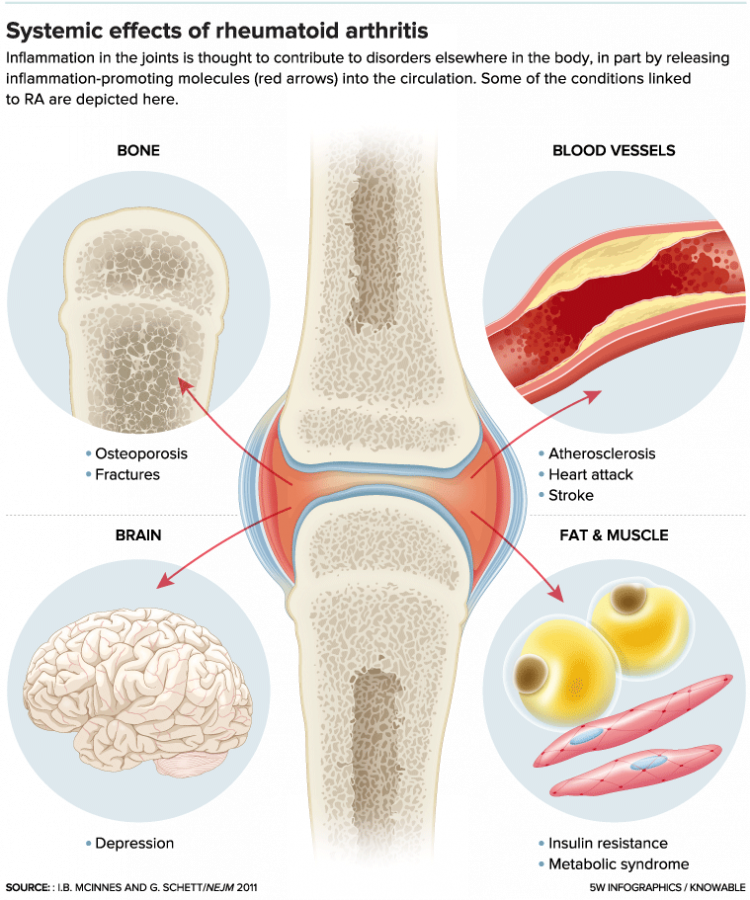 Systemic-effects-of-Rheumatoid-Arthritis-3.png